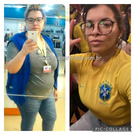 Nutricionista Bariatrica Especialista Em Nutri O Br