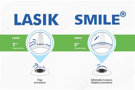 Lasik Vs Smile Which Refractive Procedure Is Right For You Planet