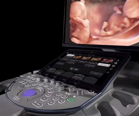 The Arrival Of The GE Voluson Expert 22 Ultrasound Machine