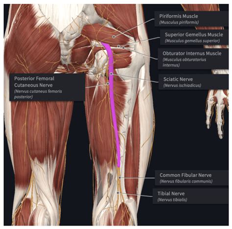 I Have Sciatica Advanced Clinical Education Educating Mentoring