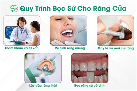 Quy trình bọc răng sứ cho răng cửa và những điều cần lưu ý