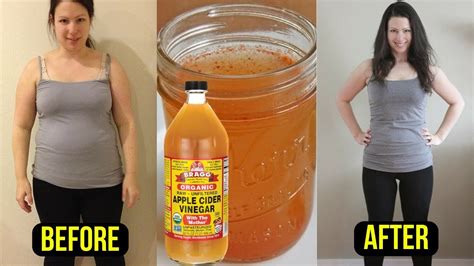 Take 1 Tablespoon Of Apple Cider Vinegar And Burn Belly Fat Fast Fat Burning Drink Youtube