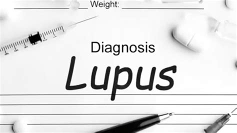 Understanding Lupus Symptoms And Treatment YouTube