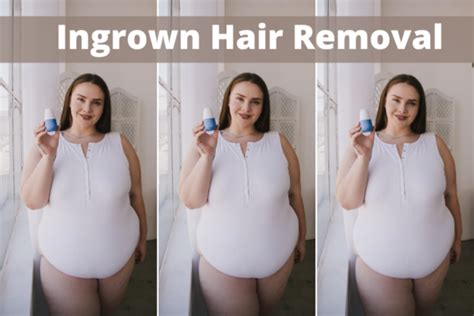 5 Incredible Ingrown Hair Removal Products for Models - How To Become A Plus Size Model