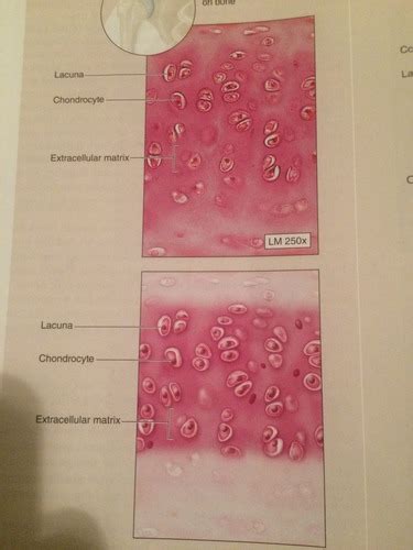 Supporting Connective Tissue Flashcards Quizlet