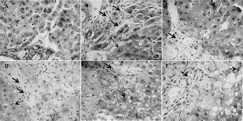 Histological Analysis Of Livers After Ga And Dga Treatments In Rats