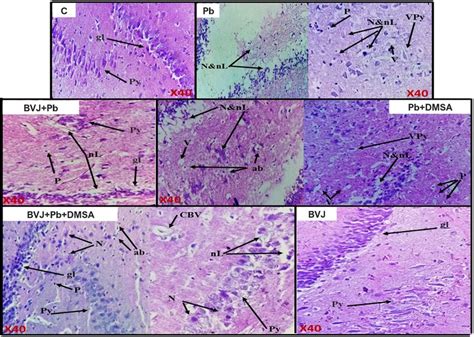 Representative photomicrographs of the hippocampus in the brain of ... 