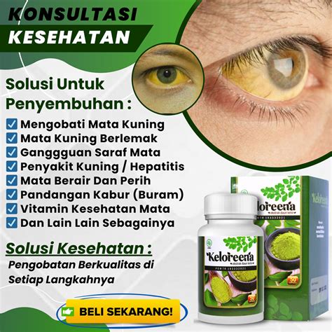 Jual Obat Mata Kuning Penjernih Mata Kuning Penyakit Liver Hepatitis A