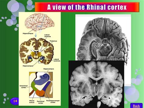 Ppt The Mtl Role In Memory And Perception Powerpoint Presentation