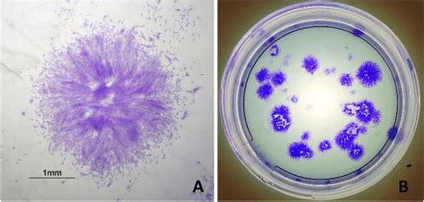 A Microscopic Illustration Of A Colony From Group C B Macroscopic