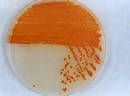 Microbiolog A Cultivo Puro