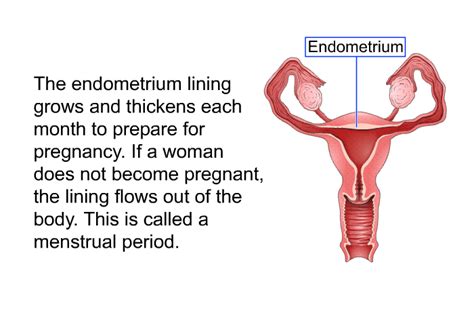 PatEdu Uterine Cancer