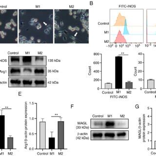 MAGL Knockdown Enhances The Mitophagy Of M1 Macrophages In Vitro A