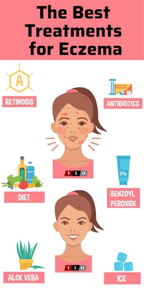 Common Eczema Triggers to Avoid – Your Lifestyle Options