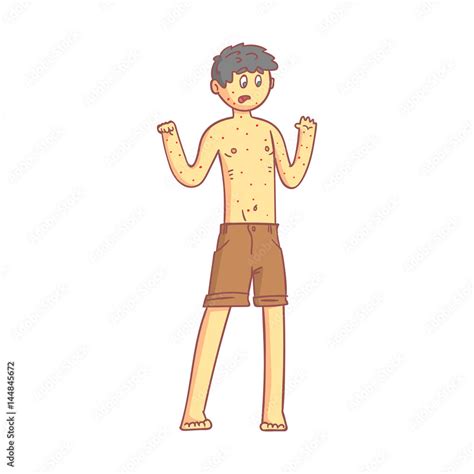 Naked Boy Teenager With A Rash On His Body Colorful Cartoon Character