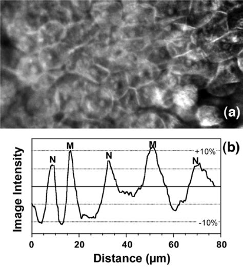 (a) 340 μm x 180 μm raw image of a single ex vivo human esophagus ...