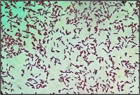 Listeria Monocytogenes