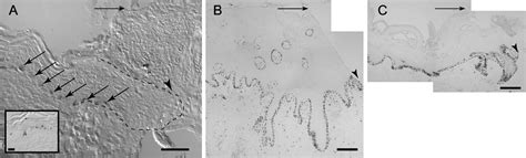 Keratinocyte Migration Proliferation And Differentiation In Chronic