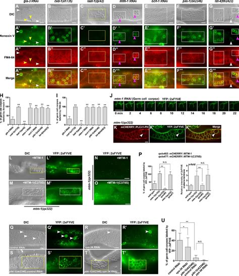 Figure S Mtm Regulates Ptdins P Levels On Plasma Membranes