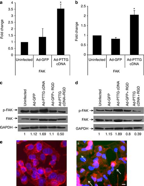 RNA expression of FAK and protein expression of p-FAK and FAK. (a, b ...