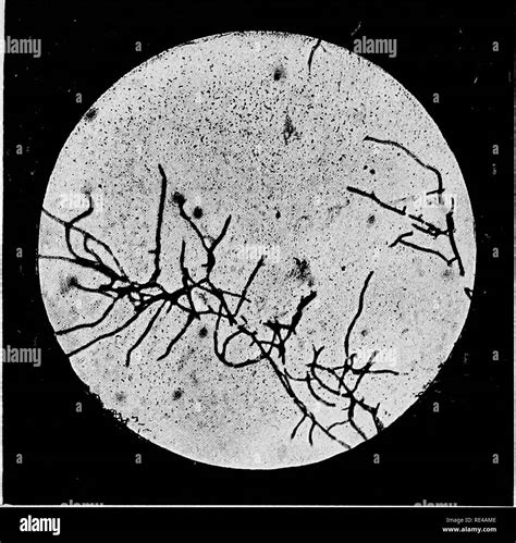 Cilia micrograph hi-res stock photography and images - Alamy