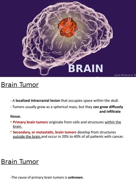 Understanding Brain Tumors In 40 Characters Pdf Brain Tumor