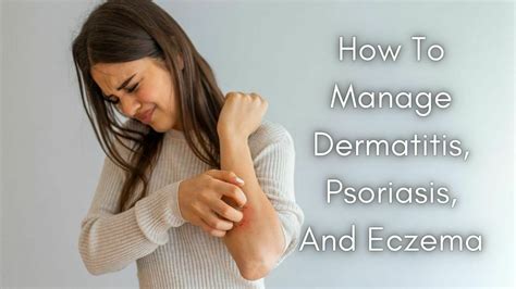 How To Manage Dermatitis, Psoriasis, And Eczema – VnMaths Educational ...