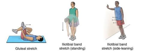 Hip Bursitis Pt Exercises