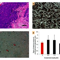 Histology Proliferation And Apoptosis Of Tumor Xenograft Characteristics In Nude Nu Nu Mice