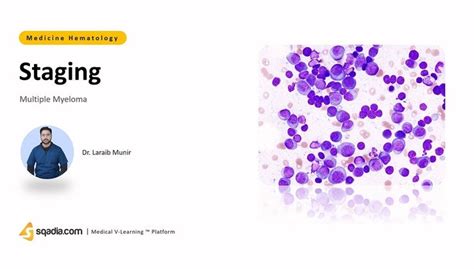 Multiple Myeloma - Staging