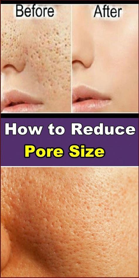 How To Reduce Pore Size Artofit