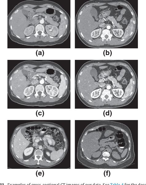 Figure From Abdominal Multi Organ Segmentation From Ct Images Using