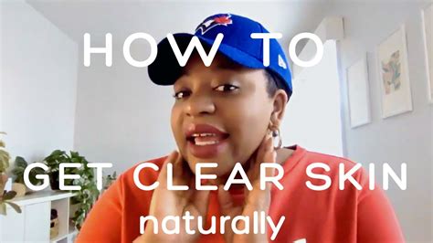 How To Get Clear Skin Naturally Without Products Youtube