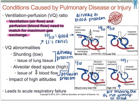 Patho Exam 5 Respiratory Disorders Pt 2 3 Flashcards Quizlet