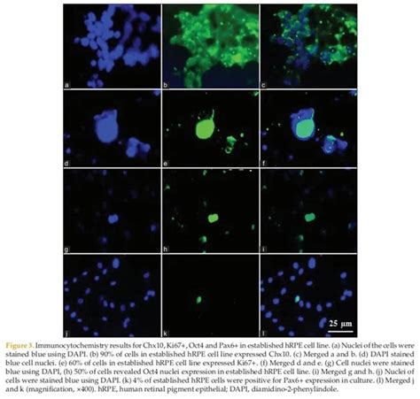 Immortalized Human Retinal Pigment Epithelial Cells