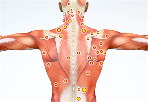 Curso De Libera O Miofascial Manual E Terapia De Pontos Gatilhos