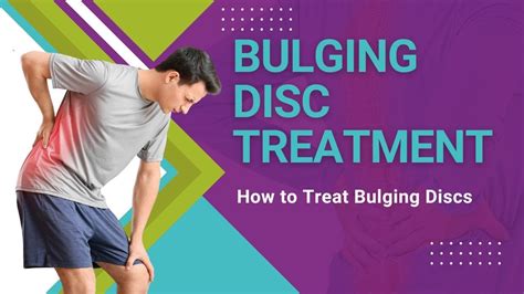 Bulging Disc Treatment How To Treat Bulging Discs Youtube