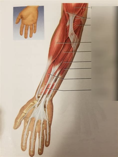 Ch 13 Fig 136 Superficial Flexor Muscles Of The Forearm Anterior View Diagram Quizlet