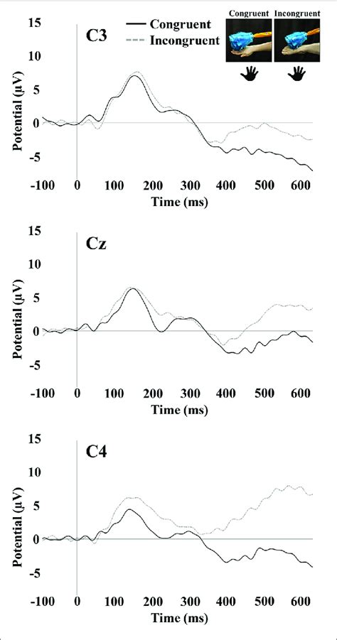 Sep Responses To Tactile Stimulation Of The Infants Right Hand The