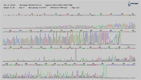 DNA sequencing (reverse) for patient no. 5 detect with Inv1. | Download ...