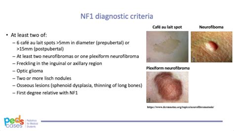 Neurocutaneous Syndrome