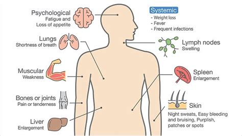 What Are Some Of The Common Symptoms Of Leukemia Everyday Health