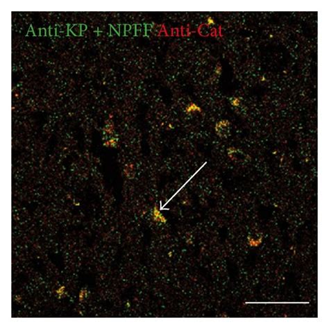 Double Labeling Immunofluorescence Demonstrating Colocalization Of Kp Download Scientific