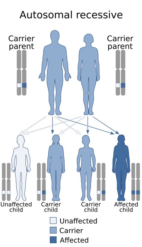 Medicine:Norman–Roberts syndrome - HandWiki