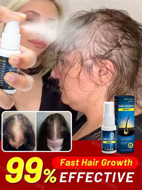 Hair Growth Products For Men Women Hair Loss Treatment Fast Grow Hair Spray Regrowth Thicken Oil