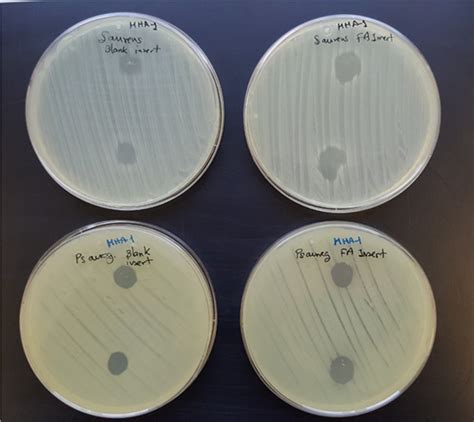 Staphylococcus Aureus First Row And Pseudomonas Aeruginosa Second