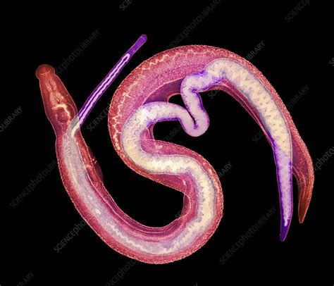 LM of male and female adult schistosome parasites - Stock Image - Z160 ... 