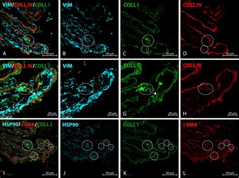 Type I Collagen Intracellular Staining In Ierm A D Type I Collagen Download Scientific