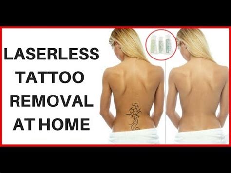 How To Remove Tattoo At Home Naturally Without Laser Laserless Tattoo