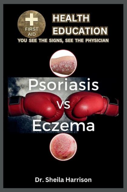 Psoriasis Vs Eczema Differences Similarities Types Symptoms